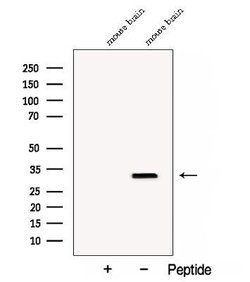 Invitrogen Clathrin Light Chain Polyclonal Antibody 100 &mu;L; Unconjugated:Antibodies,