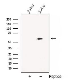 Invitrogen CNOT6 Polyclonal Antibody 100 &mu;L; Unconjugated:Antibodies,