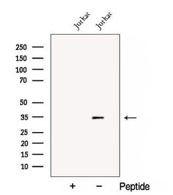 Invitrogen CNOT8 Polyclonal Antibody 100 &mu;L; Unconjugated:Antibodies,