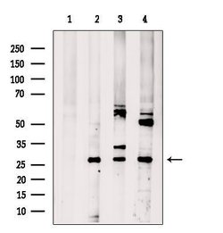 Invitrogen CNOT8 Polyclonal Antibody 100 &mu;L; Unconjugated:Antibodies,