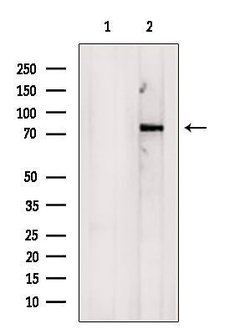 Invitrogen COL23A1 Polyclonal Antibody 100 &mu;L; Unconjugated:Antibodies,