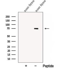 Invitrogen COL23A1 Polyclonal Antibody 100 &mu;L; Unconjugated:Antibodies,