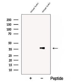 Invitrogen COQ5 Polyclonal Antibody 100 &mu;L; Unconjugated:Antibodies,