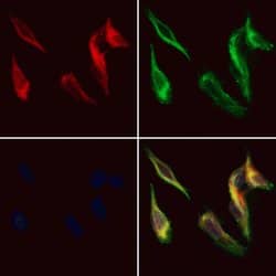 Invitrogen CRISP3 Polyclonal Antibody 100 &mu;L; Unconjugated:Antibodies,