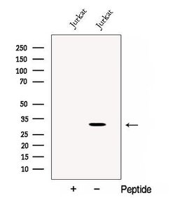 Invitrogen CRISP3 Polyclonal Antibody 100 &mu;L; Unconjugated:Antibodies,
