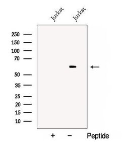 Invitrogen DPYSL3 Polyclonal Antibody 100 &mu;L; Unconjugated:Antibodies,