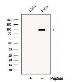 Invitrogen CSDE1 Polyclonal Antibody 100 &mu;L; Unconjugated:Antibodies,