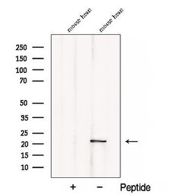 Invitrogen CSRP3 Polyclonal Antibody 100 &mu;L; Unconjugated:Antibodies,