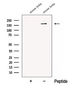 Invitrogen CTTNBP2 Polyclonal Antibody 100 &mu;L; Unconjugated:Antibodies,