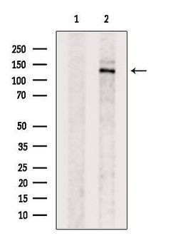Invitrogen CYFIP2 Polyclonal Antibody 100 &mu;L; Unconjugated:Antibodies,
