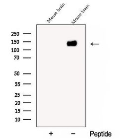 Invitrogen CYFIP2 Polyclonal Antibody 100 &mu;L; Unconjugated:Antibodies,