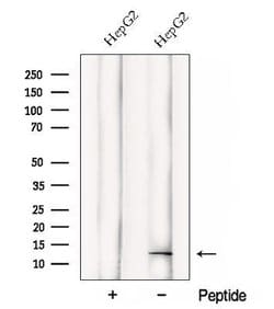 Invitrogen DDA1 Polyclonal Antibody 100 &mu;L; Unconjugated:Antibodies,