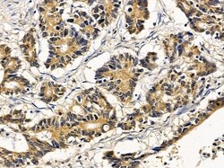 Invitrogen DDHD2 Polyclonal Antibody 100 &mu;L; Unconjugated:Antibodies,