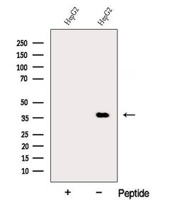 DDRGK1 Polyclonal Antibody 100 &mu;L | Buy Online | Thermo Scientific | Fisher Scientific