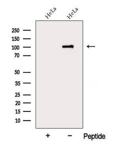 Invitrogen DDX10 Polyclonal Antibody 100 &mu;L | Buy Online | Invitrogen&trade; | Fisher Scientific