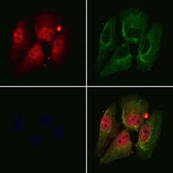 Invitrogen DDX17 Polyclonal Antibody 100 &mu;L; Unconjugated:Antibodies,