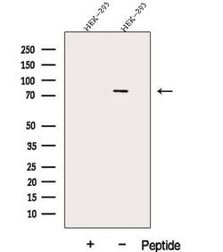 Invitrogen DDX17 Polyclonal Antibody 100 &mu;L; Unconjugated:Antibodies,