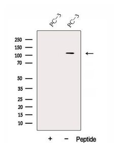Invitrogen DHX36 Polyclonal Antibody 100 &mu;L; Unconjugated:Antibodies,