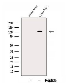 Invitrogen™ SAPAP3 Polyclonal Antibody