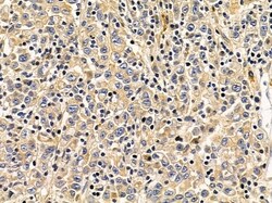 Invitrogen DNAJC21 Polyclonal Antibody 100 &mu;L | Buy Online | Invitrogen&trade; | Fisher Scientific