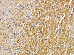 Invitrogen DNAJC21 Polyclonal Antibody 100 &mu;L | Buy Online | Invitrogen&trade; | Fisher Scientific