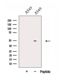 Invitrogen DNASE2B Polyclonal Antibody 100 &mu;L; Unconjugated:Antibodies,