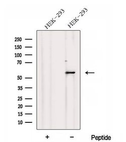 Invitrogen DNPEP Polyclonal Antibody 100 &mu;L; Unconjugated:Antibodies,