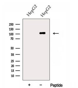 Invitrogen DSE Polyclonal Antibody 100 &mu;L; Unconjugated:Antibodies,