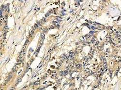 Invitrogen DYNC1LI2 Polyclonal Antibody 100 &mu;L | Buy Online | Invitrogen&trade; | Fisher Scientific