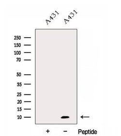 Invitrogen Dynein Polyclonal Antibody 100 &mu;L; Unconjugated:Antibodies,