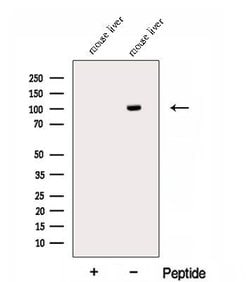 Invitrogen ECE2 Polyclonal Antibody 100 &mu;L; Unconjugated:Antibodies,