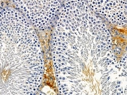 Invitrogen EHBP1 Polyclonal Antibody 100 &mu;L; Unconjugated:Antibodies,