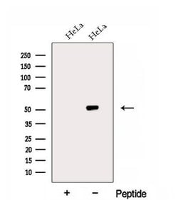 Invitrogen eIF2 gamma Polyclonal Antibody 100 &mu;L; Unconjugated:Antibodies,