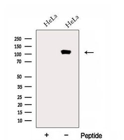 Invitrogen EMILIN1 Polyclonal Antibody 100 &mu;L; Unconjugated:Antibodies,