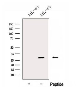 Invitrogen ENOPH1 Polyclonal Antibody 100 &mu;L; Unconjugated:Antibodies,
