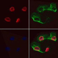 Invitrogen EPCR Polyclonal Antibody 100 &mu;L; Unconjugated:Antibodies,