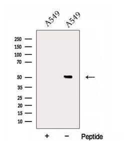Invitrogen EPCR Polyclonal Antibody 100 &mu;L; Unconjugated:Antibodies,