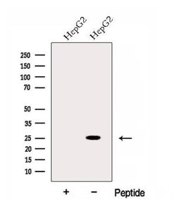 Invitrogen EVI2A Polyclonal Antibody 100 &mu;L; Unconjugated:Antibodies,