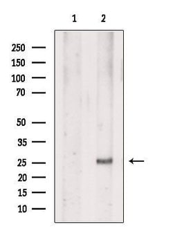 Invitrogen EVI2A Polyclonal Antibody 100 &mu;L; Unconjugated:Antibodies,
