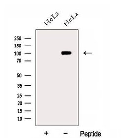 Invitrogen EXOSC10 Polyclonal Antibody 100 &mu;L; Unconjugated:Antibodies,
