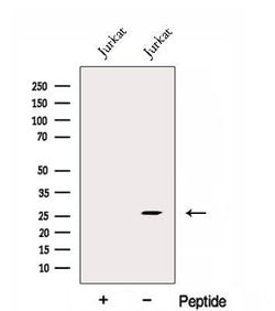 Invitrogen EXOSC4 Polyclonal Antibody 100 &mu;L | Buy Online | Invitrogen&trade; | Fisher Scientific