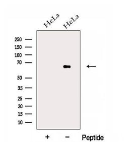 Invitrogen EYA3 Polyclonal Antibody 100 &mu;L; Unconjugated:Antibodies,