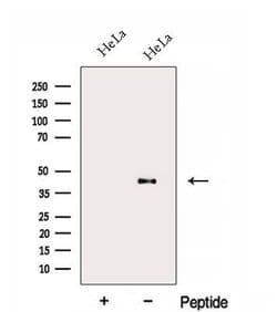 Invitrogen FA2H Polyclonal Antibody 100 &mu;L; Unconjugated:Antibodies,