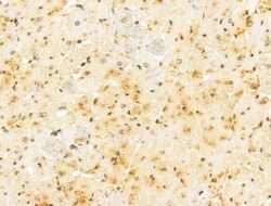 Invitrogen FBXL14 Polyclonal Antibody 100 &mu;L; Unconjugated:Antibodies,