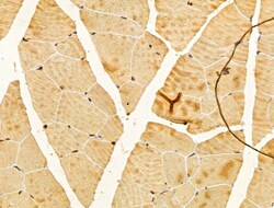 Invitrogen FBXL14 Polyclonal Antibody 100 &mu;L; Unconjugated:Antibodies,