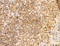 Invitrogen FBXL14 Polyclonal Antibody 100 &mu;L; Unconjugated:Antibodies,