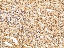 Invitrogen FBXL14 Polyclonal Antibody 100 &mu;L; Unconjugated:Antibodies,