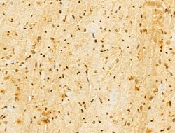 Invitrogen FBXL14 Polyclonal Antibody 100 &mu;L; Unconjugated:Antibodies,