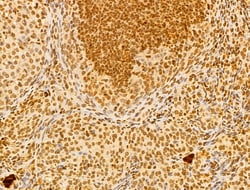 Invitrogen FBXL14 Polyclonal Antibody 100 &mu;L; Unconjugated:Antibodies,