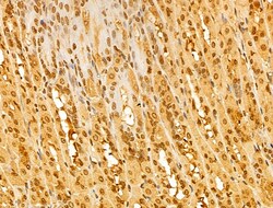 Invitrogen FBXL14 Polyclonal Antibody 100 &mu;L; Unconjugated:Antibodies,